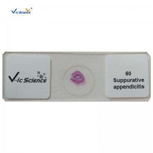 100 pz kit di patologie umane diapositive vetrini preparati al microscopio