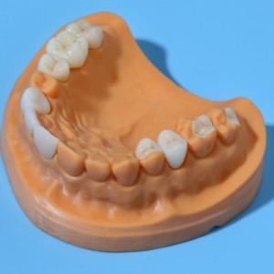 Tutto-Denti in ceramica