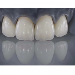 Tutto-Denti in ceramica